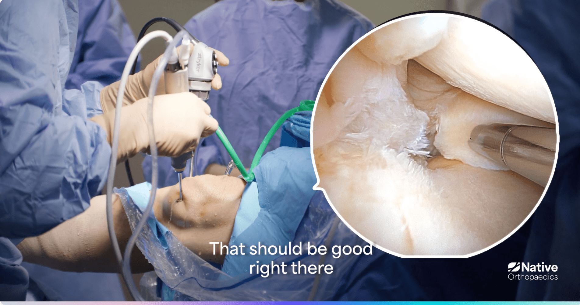 Surgical Technique | Native Orthopaedics